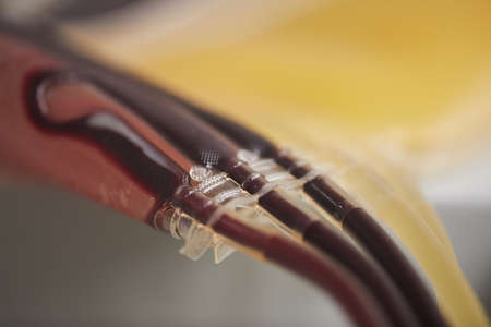 Close-up of dropper with blood samples which taken from donor at hospital