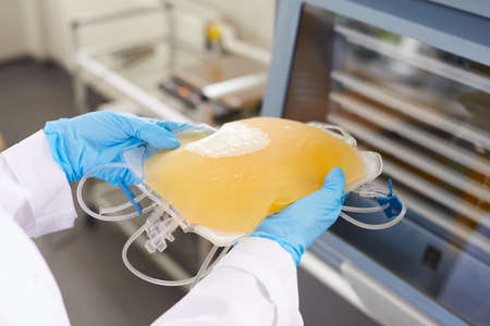 Close-up of doctor in protective gloves holding package with blood plazma at hospital