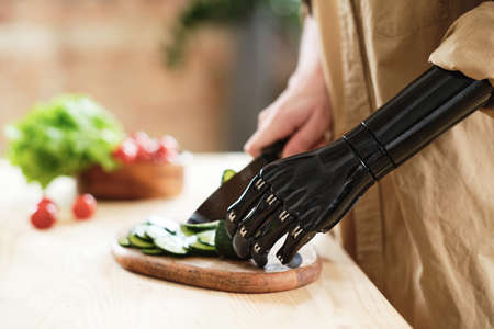 Close-up of woman with prosthetic arm cutting fresh vegetables on cutting board at the table, she...