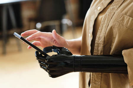 Close-up of girl with prosthetic arm adapting and learning to type a message on her mobile phoneの写真素材