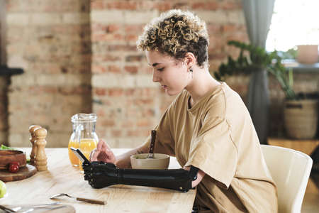 Girl with prosthetic arm typing a message on mobile phone while sitting at table and having...