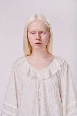 Portrait of young albino girl with white hair standing against white backgroundの写真素材