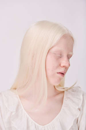 Portrait of young albino woman with white long hair and natural beautyの写真素材