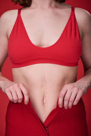 Close-up of slim female body with scar on belly in red costume isolated on red backgroundの写真素材