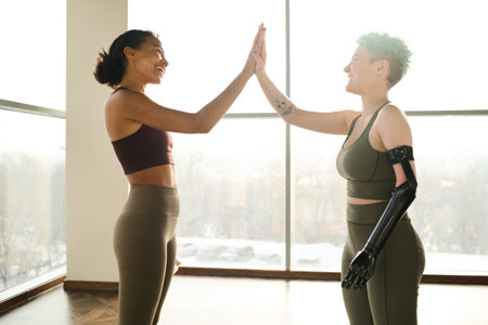 Pretty girl with prosthetic arm giving high-five to instructor while they training in gymの写真素材
