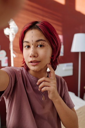 Cute teenage girl looking at camera while standing in ward of plastic surgery clinics and touching her face with liftmarks before operationの写真素材