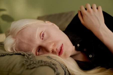 Closeup of modern young Caucasian woman with albinism lying on couch in morningの写真素材