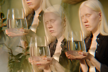 Multiple exposure shot young Caucasian woman with albinism holding aquarium with goldfish in her handsの写真素材