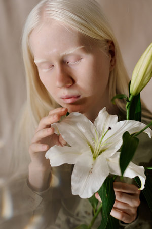 Vertical closeup of young Caucasian girl with albinism embracing beauty of fresh lilium flowerの写真素材