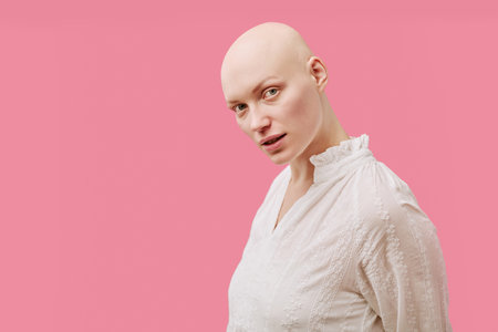 Portrait of young adult Caucasian woman with alopecia looking into camera, standing against pink background, displaying confident facial expression and wearing blouseの写真素材
