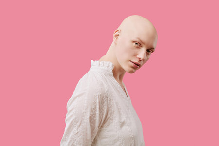 Portrait of young adult Caucasian woman with alopecia standing against pink background, tilting head slightly and gazing directly at camera, wearing blouseの写真素材