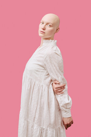Portrait of young adult Caucasian woman with alopecia standing against pink background, turning body slightly while looking directly at camera, wearing long sleeve dressの写真素材