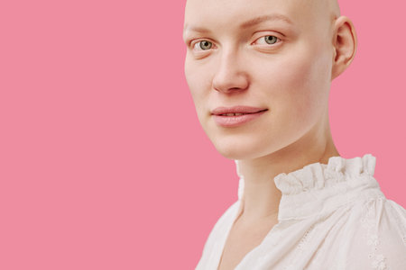 Portrait of young adult Caucasian woman with alopecia looking into camera, showing smooth bald scalp and subtle smile, wearing light blouse against plain pink backgroundの写真素材