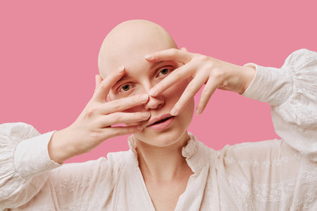 Portrait of young adult Caucasian woman with alopecia looking into camera, framing face with hands, wearing long sleeve blouse, standing against pink backgroundの写真素材