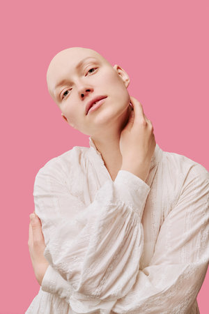 Portrait of young adult Caucasian woman with alopecia tilting head and touching neck, standing against pink background, displaying smooth scalp and serene facial expressionの写真素材