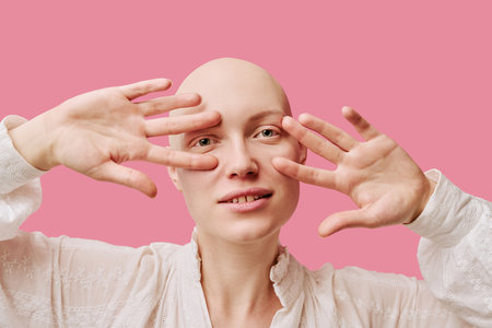 Portrait of young adult Caucasian woman with alopecia smiling and holding hands near face against pink background, showing bare scalp and natural expression, looking into cameraの写真素材