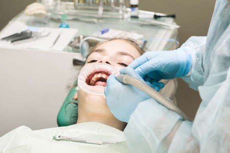 Young girl with open mouth receiving dental treatment. Close-up of dental treatment. Dental office.の写真素材