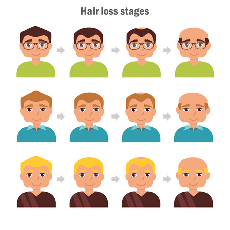 Types of hair loss. illustration. Cartoon character. Isolated Manのイラスト素材