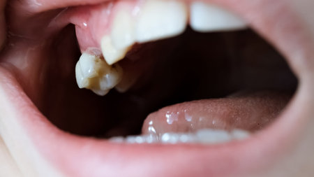 Child moves a milk loose tooth and presses on it with a tongue. Open mouth of a caucasian 9 year old...