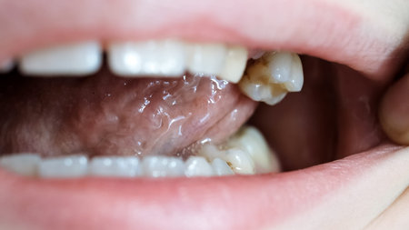Child moves a milk loose tooth and presses on it with a tongue. Open mouth of a caucasian 9 year old...