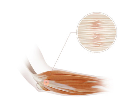 This is a thorough anatomical representation of arm muscles with a detailed focus fasciae