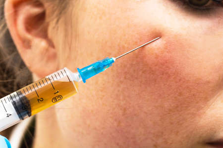 Ordinary woman in beauty clinic getting botox injection to remove eye wrinklesの写真素材