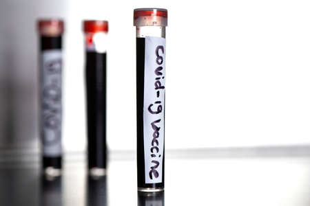Blood sample of convid-19 vaccine, coronavirus covid-19 virus in the blood sample tube along with...
