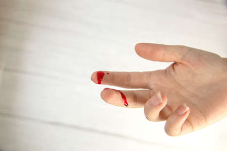 hand injury with blood, blood wound cut top view, copy space, medical concept needs stitchesの写真素材