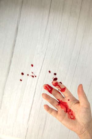 hand injury with blood, blood wound cut top view, copy space, medical concept needs stitchesの写真素材