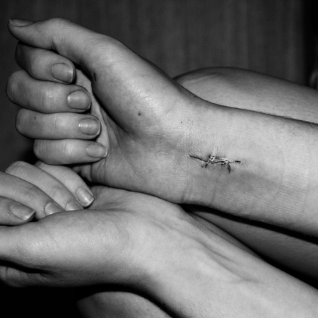 The consequences of suicide. The surgical suture on the female wrist. The stitched wound on his arm. Square black and white photo.の写真素材