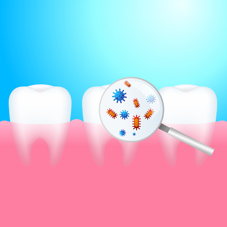 Toothache. A tooth with dental caries and pain. Protection against bacteria on the magnifying glass Vector realistic illustrationのイラスト素材