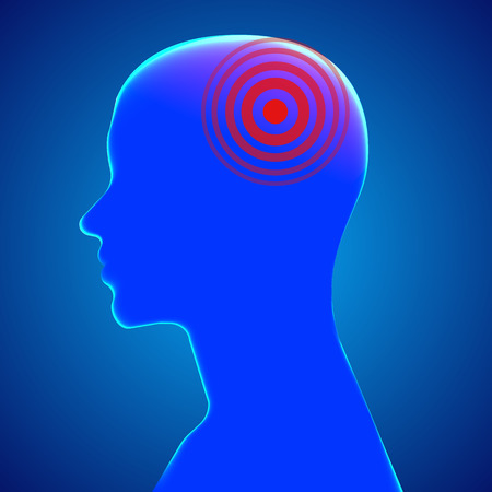 Headache. Male head with pain dot. Vector illustrationのイラスト素材