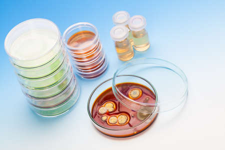 Petri dish with colonies of microorganisms