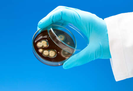 petri dish with bacterial colonies in the hand,  on blue background