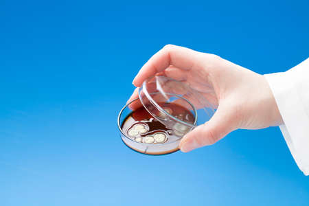 Petri dish with colonies of bacteria in hand