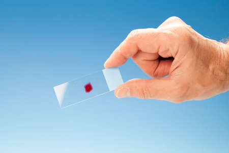 The slides for microscope cytological biopsy researchの写真素材