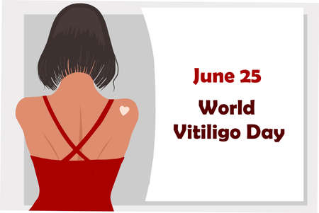 June 25 - World Vitiligo Day. Pigmentation disorders. Skin depigmentation. Vector illustration on the theme of rare diseases. Chronic skin disease.のイラスト素材