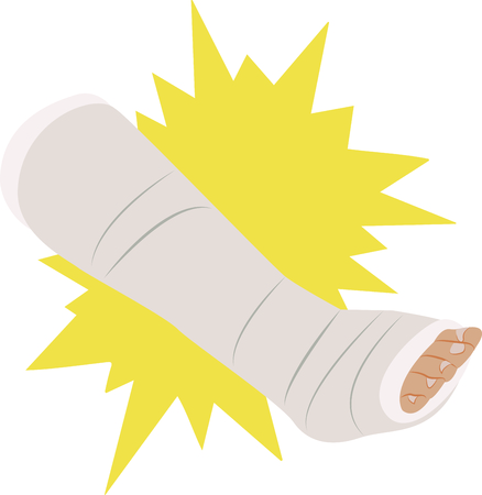 Doctors, nurses and med students will enjoy this leg cast design. This will look great on t-shirts, banners, tote bags and more.のイラスト素材