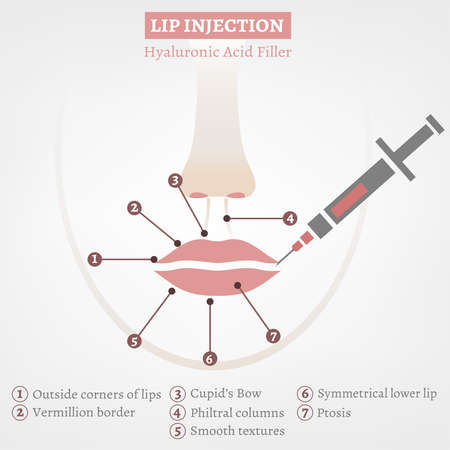 Lips Injections Imageのイラスト素材