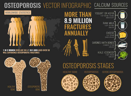 Osteoporosis Infographic Posterのイラスト素材
