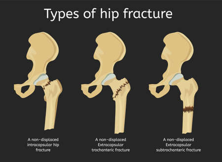 Arrayのイラスト素材