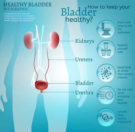 How to keep your bladder healthy. Medical infographic with useful facts about urinary system. Editable vector illustration with pictograms. Medicine, healthcare, urology concept.のイラスト素材