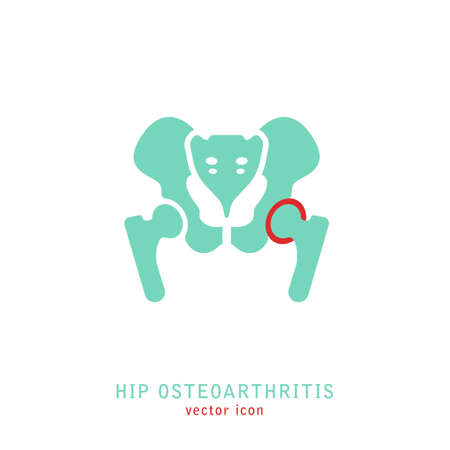 Hip Osteoarthritis Icon. Flat style. Lower back and joint pain. Editable vector illustration isolated on a white background. Medical, healthcare, elderly diseases graphic concept.のイラスト素材