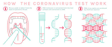 Coronavirus test infographic. Throat mucus swab. Biological material analysis. Positive result. Virus testing. Editable vector illustration on a white background. Medical, healthcare conceptのイラスト素材