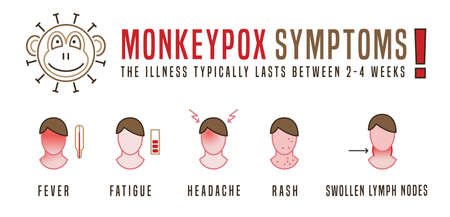 Main monkeypox symptoms. Pox virus icons. Vector illustrationのイラスト素材