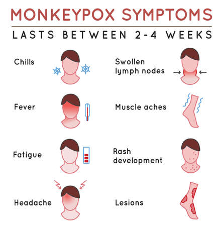 Monkeypox virus symptoms. Editable vector illustration. Medical infographicのイラスト素材