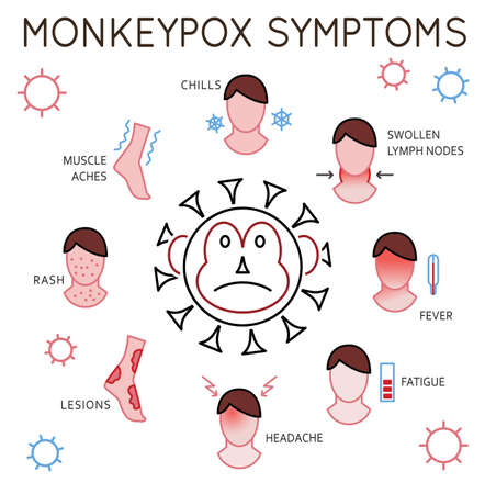 Main monkeypox virus symptoms. Editable vector illustrationのイラスト素材