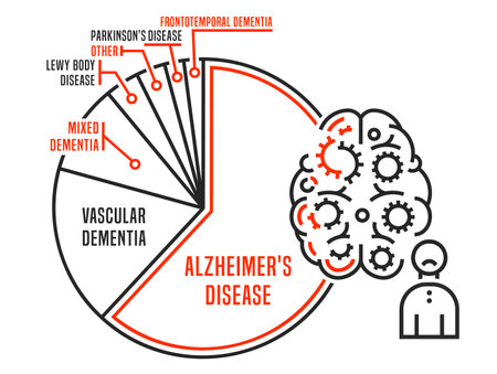 Vector dementia infographic in outline style. Editable illustrationのイラスト素材
