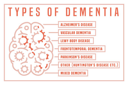 Vector dementia infographic in outline style. Editable illustrationのイラスト素材
