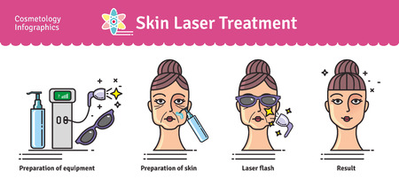 Vector Illustrated set with salon cosmetology skin laser treatment. Infographics with icons of medical cosmetic procedures for skin.のイラスト素材